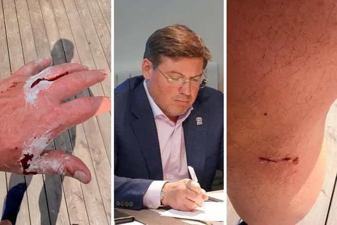 На бывшего депутата ЗСО Алексея Денисенко напали бродячие собаки во время прогулки на Северо‑Западе Челябинска. Он получил пять ран, обратился в травмпункт и призывает пересмотреть закон об ответственном обращении с животными.