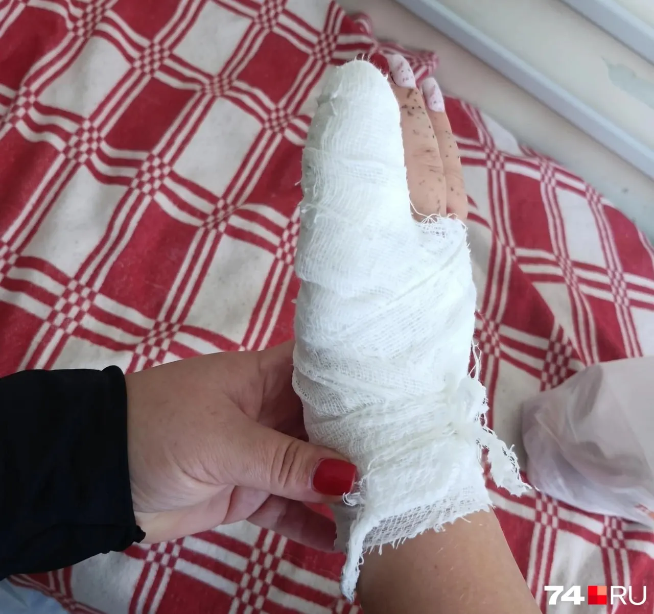 10-летняя девочка получила травму пальца на детской площадке: кончик пальца зажат между рукояткой и основанием тренажёра; в больнице кончик пальца зашили под наркозом, сейчас ведётся расследование.
